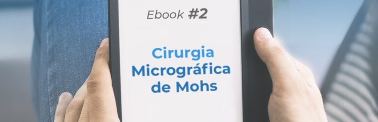 Novo Ebook: Cirurgia Micrográfica de Mohs